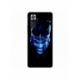 Husa personalizata tip carcasa HQPrint pentru Xiaomi Redmi Note 11 Pro Plus 5G, model Blue King, multicolor, S1D1M0305